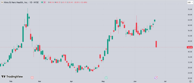 TradingView