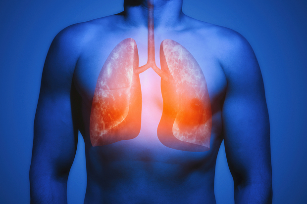 FDA Accepts GSK's Filing for Expanded Use of Nucala in COPD