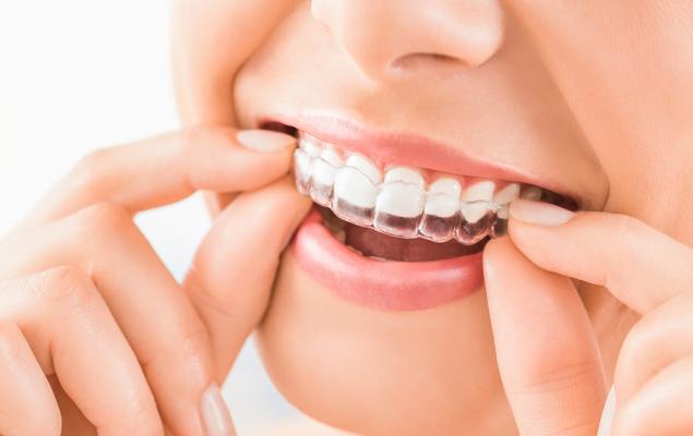 3 Stocks From the Growing Digital Orthodontic Space in Focus